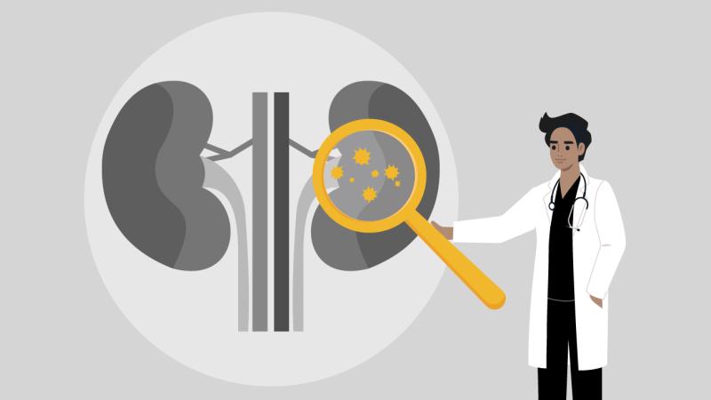 A cartoon graphic of a physician pointing at some kidneys.