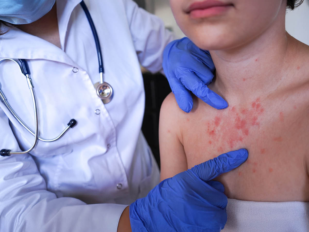 Doctor examining a patient with measles
