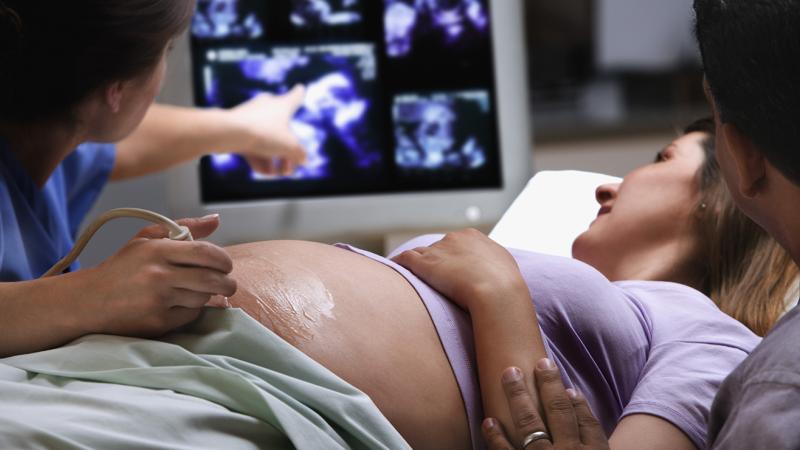 woman getting an ultrasound