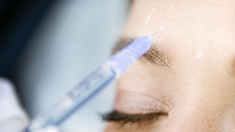 Botox injection